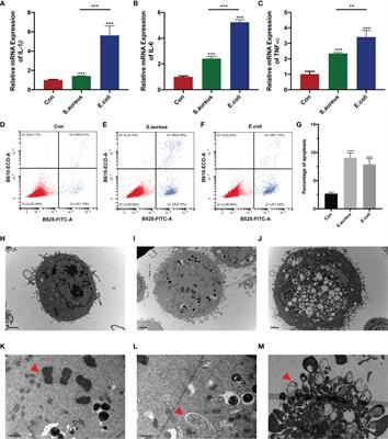 N6-Methyladenosine-Modified circRNA in the Bovine Mammary Epithelial Cells Injured by Staphylococcus aureus and Escherichia coli